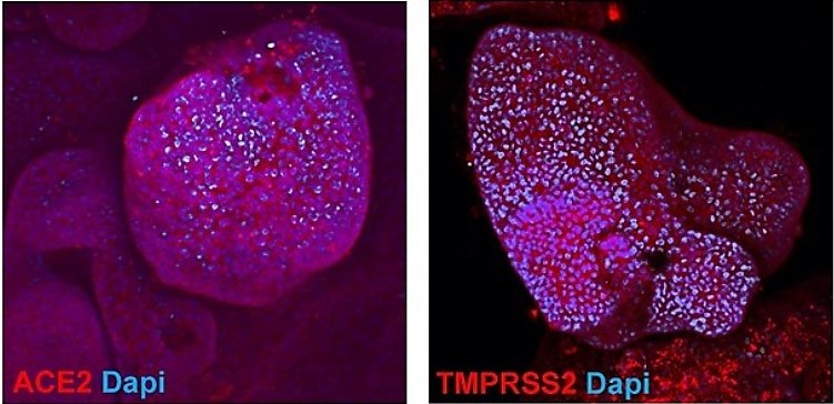 Microscopy images of colon organoids stained with antibodies Microscopy images of colon organoids stained with antibodies