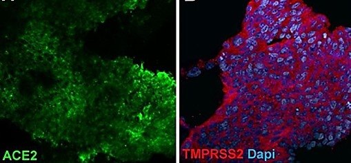 Microscopy images of lung organoids stained with antibodies Microscopy images of lung organoids stained with antibodies