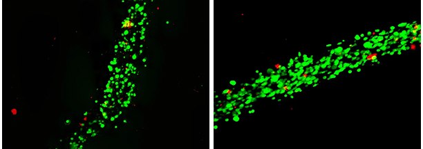 Bioprinting of human mesenchymal stem cells using PhotoCol Bioprinting of human mesenchymal stem cells using PhotoCol