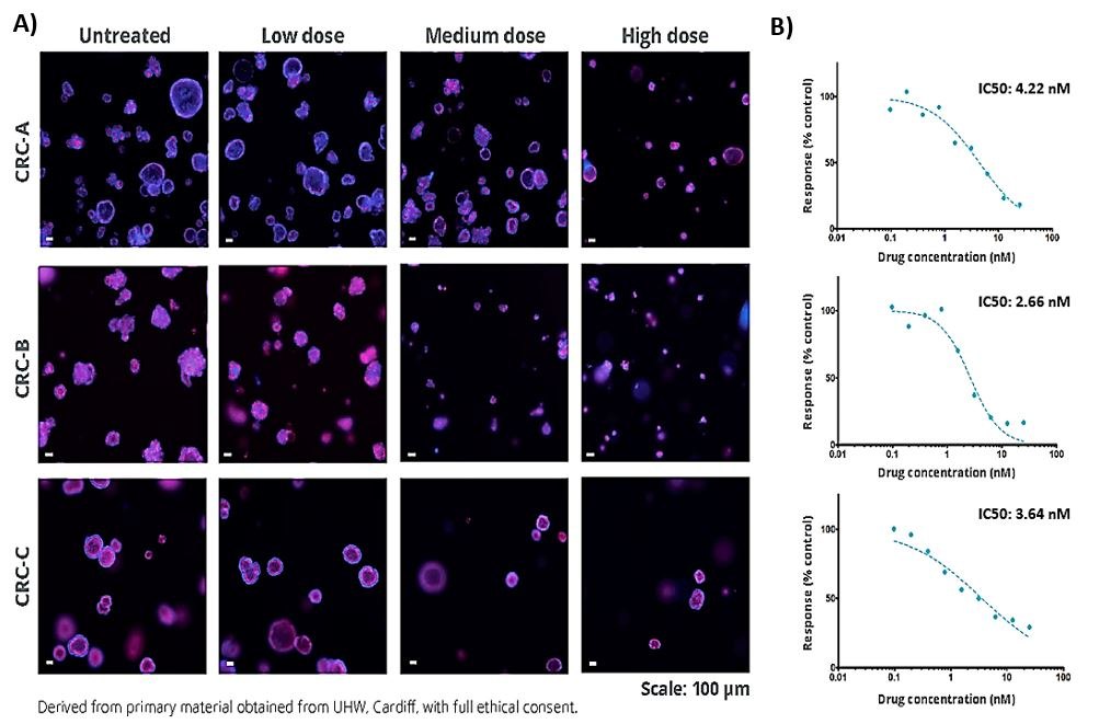 Drug screening using 3dGRO™ Human CRC Organoids Confocal microscopy images of human CRC organoids in a drug screening experiment.