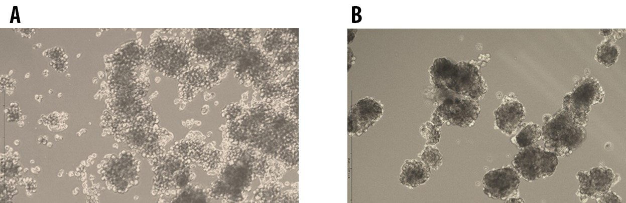 Tumorsphere formation of E006AA Prostate Cancer Cells at Passage 1 (A) and Passage 5 (B) cultured in 3dGRO<sup>®</sup> Spheroid Medium. Tumorsphere formation of E006AA Prostate Cancer Cells at Passage
