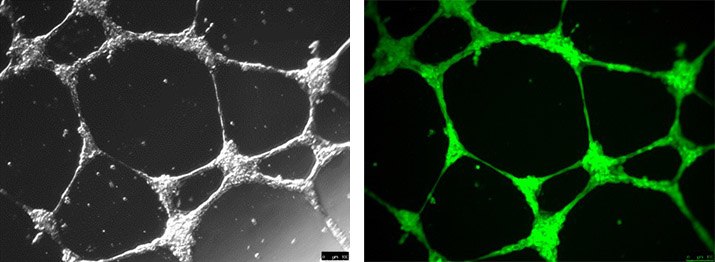 Angiogenesis tube formation using ECM Gel Matrix. HUVEC cells stained green using Calcein-AM (17783) after induction of angiogenesis. Angiogenesis tube formation using ECM Gel Matrix