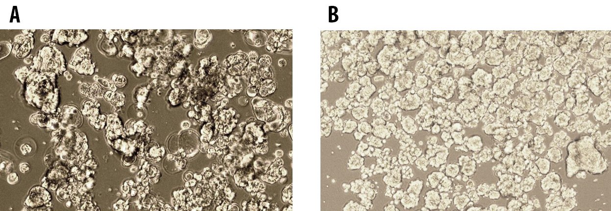 Tumorsphere formation of MCF7 Breast Cancer Cells at Passage 1 (A) and Passage 5 (B) cultured in 3dGRO<sup>®</sup> Spheroid Medium. Tumorsphere formation of MCF7 Breast Cancer Cells at Passage
