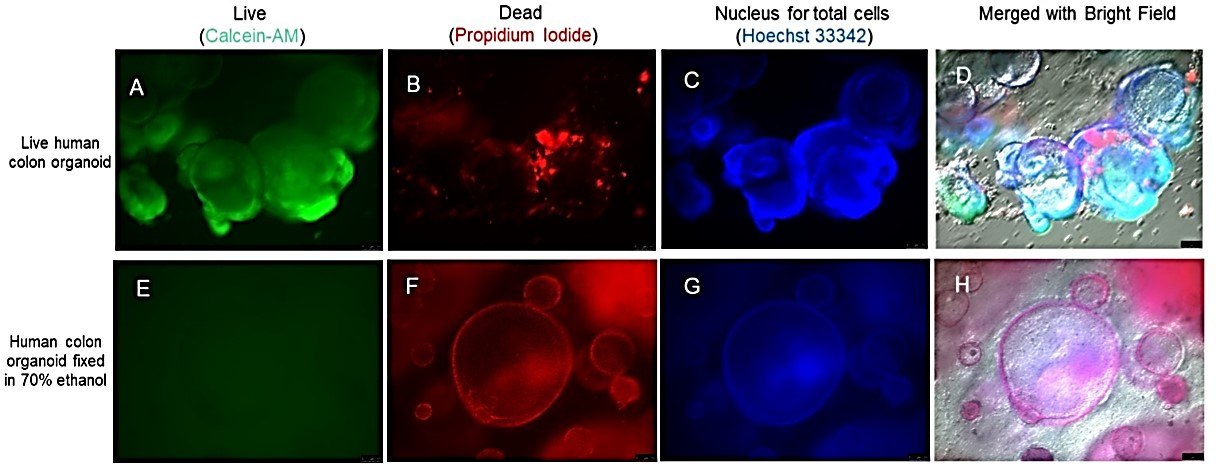 Human iPSC-derived colon organoids stained with live-dead cell viability assay kit Microscopy images of live human iPSC-derived colon organoids stained with cell viability assay kit