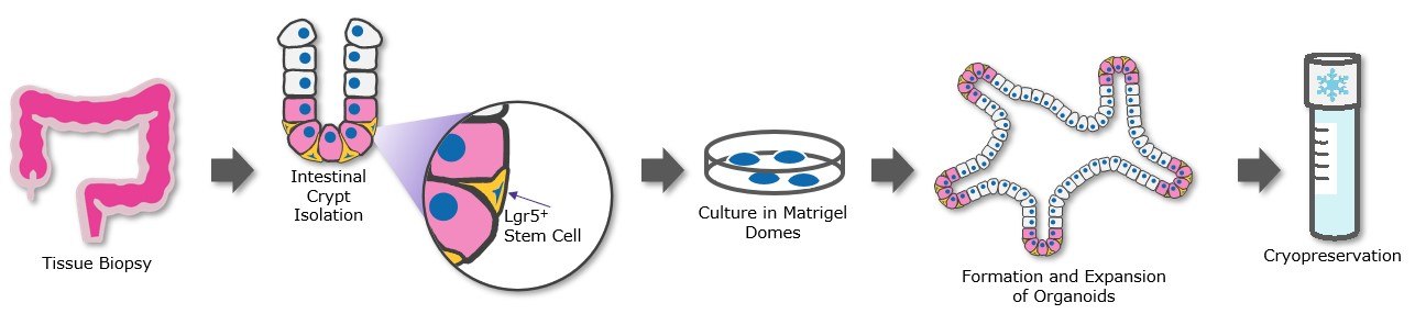 Patient derived organoids (PDOs) Isolation and cryopreservation of patient-derived organoids (PDOs) can be used to generate organoid biobanks.