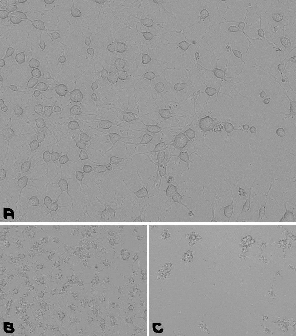 Neural stem cells culturing assay. A. Coating prepared by a 1-hour incubation at 37°C with the pre-mixed coating Solution of Laminin with PDL. B. Coating prepared by an overnight incubation with PDL, followed by a wash and a second overnight incubation with Laminin. C. NSCs were cultured for 48 hours on a TC plate without any coating. Microscopy images of cell adhesion during a neural stem cells culturing assay