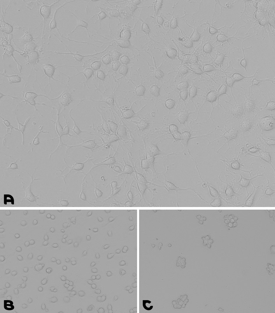 Neural stem cells culturing assay. A. Coating prepared by a 1-hour incubation at 37°C with the pre-mixed coating Solution of Laminin with PLL. B. Coating prepared by an overnight incubation with PLL, followed by a wash and a second overnight incubation with Laminin. C. NSCs were cultured for 48 hours on a TC plate without any coating. Microscopy images of cell adhesion during a neural stem cells culturing assay