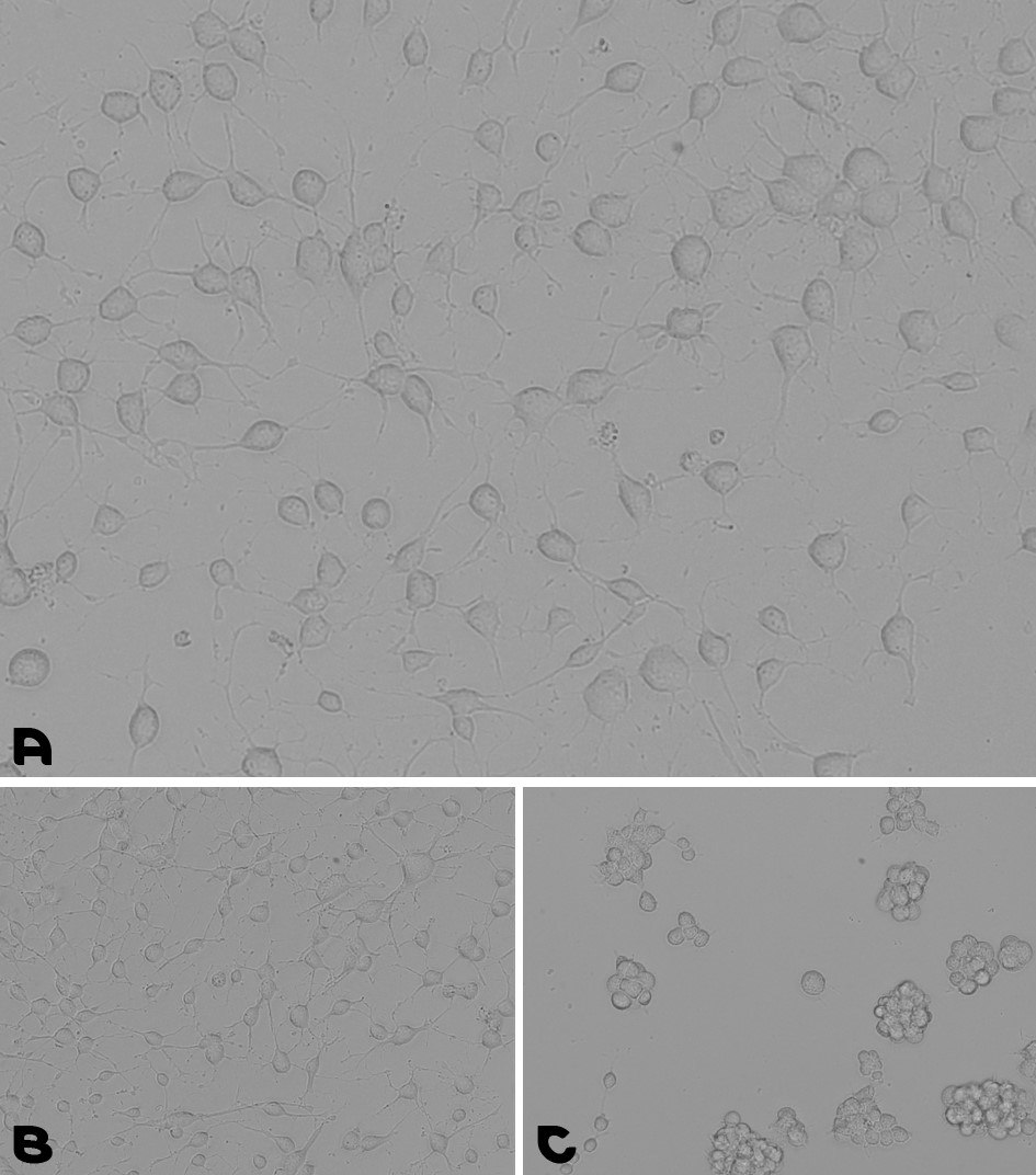 Neural stem cells culturing assay. A. Coating prepared by a 1-hour incubation at 37°C with the pre-mixed coating Solution of Laminin with PLO. B. Coating prepared by an overnight incubation with PLO, followed by a wash and a second overnight incubation with Laminin. C. NSCs were cultured for 48 hours on a TC plate without any coating. Microscopy images of cell adhesion during a neural stem cells culturing assay