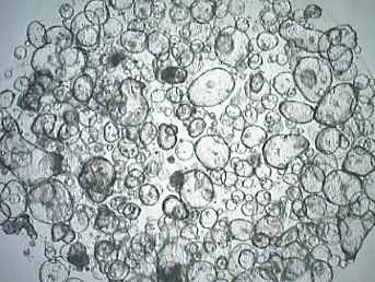 Human colon organoids. Human colon organoids