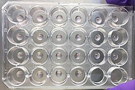 Matrigel dome organoid culture