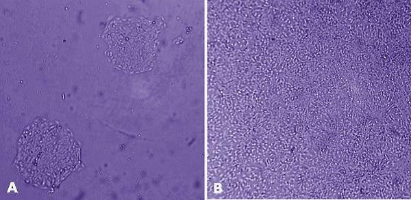 HaCaT cells (derived from human adult skin keratinocytes) were grown for 24 hours after plating on tissue culture plastic (<strong>A</strong>) and on 1% (w/v) human MaxGel<sup>™</sup> (<strong>B</strong>), which demonstrates that HaCaT cells proliferate better on MaxGel<sup>™</sup>. MaxGel™ ECM enables improved expansion of adult keratinocytes.