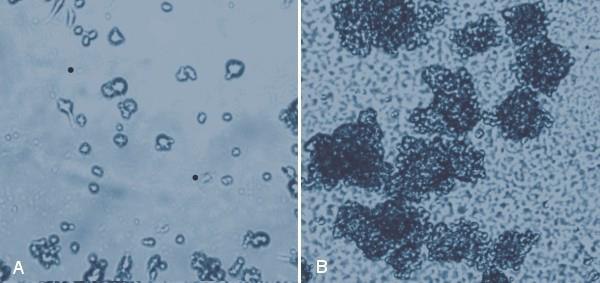 Rat neural stem cells (SCR022) were cultured on tissue culture plastic (<strong>A</strong>) where they formed few neurospheres after 24 hours, but showed excellent neurosphere formation on 1% (w/v) MaxGel<sup>™</sup> ECM after 24 hours (<strong>B</strong>). MaxGel™ ECM provides an excellent substrate for neural stem cells.