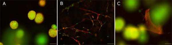 Mono- and co-culture of MCF-7 cells and fibroblasts in TrueGel3D™ hydrogels. A: MCF-7 cells cultured alone, B: human fibroblasts cultured alone, C: Co-culture of MCF-7 and fibroblasts. Red: Actin cytoskeleton; green: nuclei. Scale bar: 100 µM. Mono- and co-culture of MCF-7 cells and fibroblasts in TrueGel3D™ hydrogels