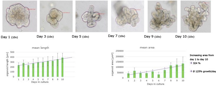 Morphology and growth of untreated human colon organoids. Morphology and growth of untreated human colon organoids. Human colonic organoids are expanded in 3D Matrigel® matrix domes for a 10 day period and increase in overall mean length and area.
