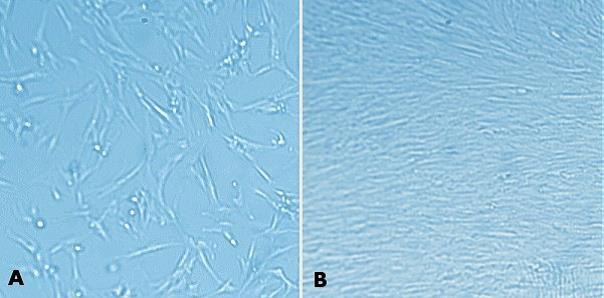 MRC-5 human fetal lung fibroblasts (05072101) were grown for 24 hours after plating on tissue culture plastic (<strong>A</strong>) and on 1% (w/v) MaxGel<sup>™</sup> ECM (<strong>B</strong>). As seen with other cells, MRC-5 cells propagate better on MaxGel<sup>™</sup> ECM. MaxGel™ ECM enables improved expansion of MRC-5 cells.