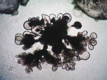 Human lung organoids. Human lung organoids.