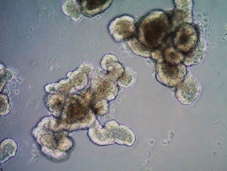 Mouse intestinal organoid. Mouse intestinal organoid.