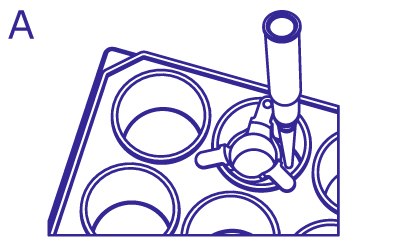 Replacing Media Using Inserts From above, pipette enters the well to the side of insert within the same well to remove the media in the well without disturbing the cells or media within the insert