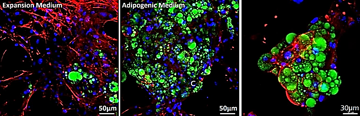 TrueGel® HTS hydrogels and 3T3-L1 adipocyte differentiation Application of TrueGel® HTS hydrogels in stem cell differentiation