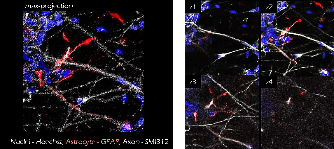 TrueGel® HTS hydrogels in iPS neuron/astrocyte co-cultures Application of TrueGel® HTS hydrogels in iPS neuron/astrocyte co-cultures