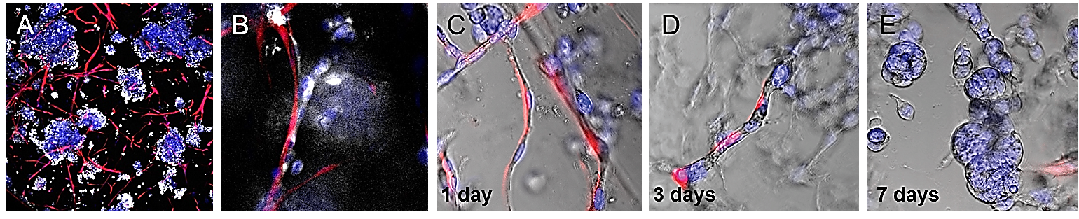 TrueGel® HTS hydrogels in tumor microenvironments TrueGel® HTS hydrogels and tumor microenvironments