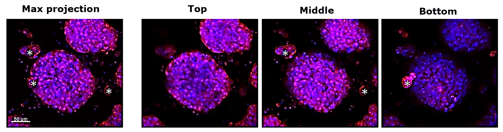 TrueGel® HTS hydrogels in tumor spheroid formation Application of TrueGel® HTS hydrogels in tumor spheroid formation and tumor cell invasion
