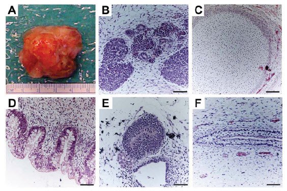 Whole teratoma derived from injection of PSC under the kidney capsule (A). Images of hematoxylin and eosin stained teratoma assay sections containing mesoderm (B, C), endoderm (D), and ectoderm (E, F). Image from16. Scale bar = 100 μM. Validating Pluripotency