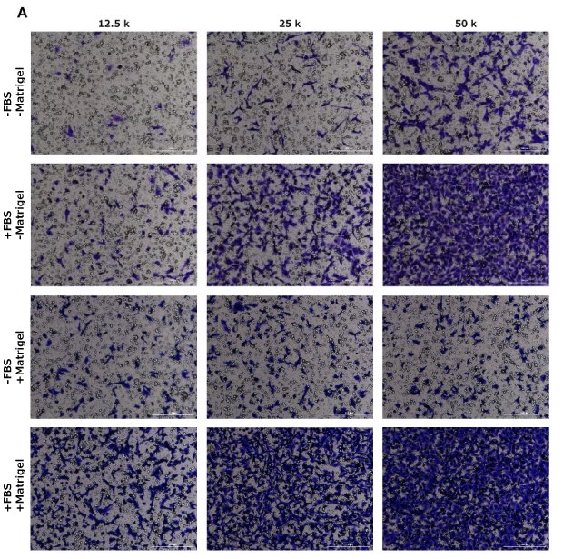 Fig 3A Cell migration assay, crystal violet staining, HT1080, NIH 3T3, MCF-7