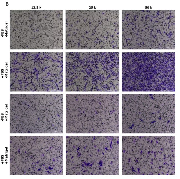 Fig 3B Cell migration assay, crystal violet staining, HT1080, NIH 3T3, MCF-7