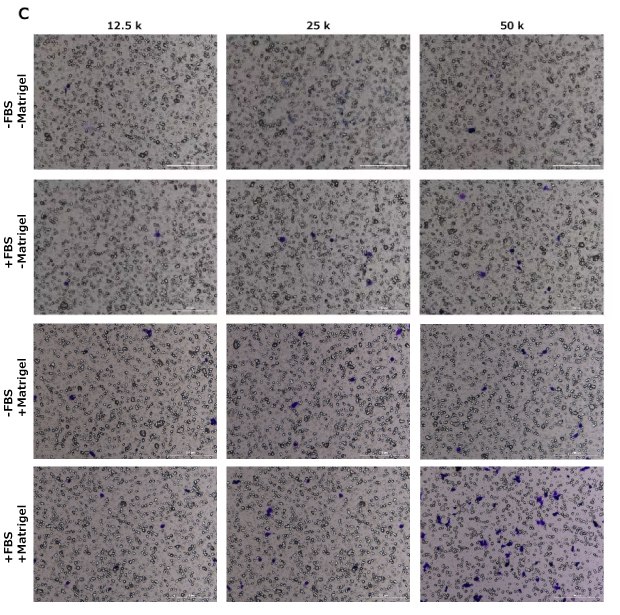 Fig 3C Cell migration assay, crystal violet staining, HT1080, NIH 3T3, MCF-7