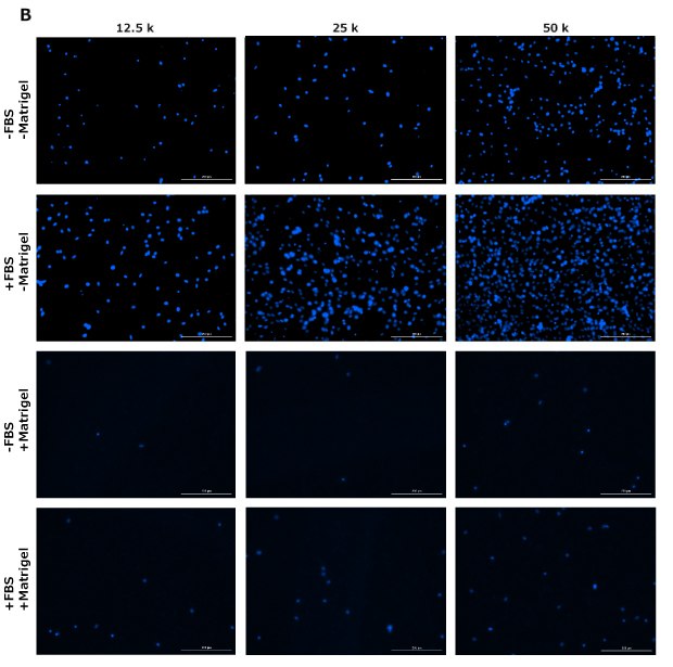 Fig 4B DAPI staining of cells in migration assay
