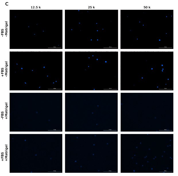 Fig 4C DAPI staining of cells in migration assay