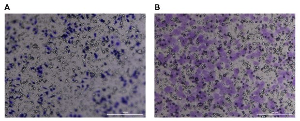 Fig 6 Crystal violet staining of Millicell® inserts