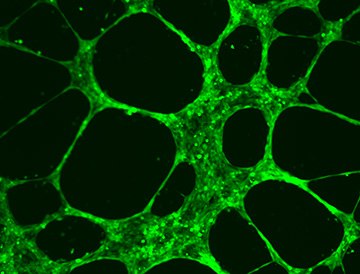 HUVEC Angiogenesis Assay. HUVEC Angiogenesis Assay