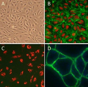 Cobblestone morphology of Human Umbilical Vein Endothelial Cells, HUVEC; (B) HUVEC immunolabeled with VEGFR2 antibodies (green); (C) HUVEC stained with DiI-Ac-LDL (red), the acetylated apoprotein specifically recognized and endocytosed by endothelial cells; (D) HUVEC form vessel-like CD31/PECAM positive (green) structures when cultured with Human Dermal Fibroblasts in the presence of VEGF. Cobblestone morphology