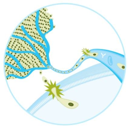 La metástasis tumoral es un proceso de varios pasos que involucra la adhesión de las células cancerosas, la migración celular y la invasión de tejidos vecinos y la vasculatura. La metástasis tumoral es un proceso de varios pasos que involucra la adhesión de las células cancerosas, la migración celular y la invasión de tejidos vecinos y la vasculatura