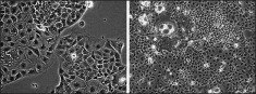 Caco-2 cells in culture. Caco-2 cells in culture. Caco-2 cells at low density (first panel) and high density (second panel).