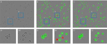 Cell Counting Examples The Power of Cloud-based Cell Counting