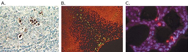 A) Detection of apoptotic cells in human lymph node with ApopTag<sup>®</sup> Peroxidase (S7200). The tissue was fixed in 10% neutral-buffered formalin and paraffin-embedded. B) Detection of apoptotic cells with ApopTag<sup>®</sup> Fluorescein Direct kit (S7160) in mouse embryo forelimb bud, fixed with 10% neutral-buffered formalin and paraffin-embedded. C) Detection of apoptotic cells with ApopTag<sup>®</sup> Red (S7165) in human lymph node tissue, fixed with 10% neutral-buffered formalin and paraffin-embedded. Detection of apoptotic cells