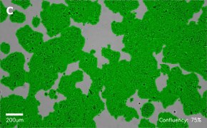 millicell-cell-lines-01042712-c Brightfield imaging of Huh-7D12 cells on Millicell<sup>®</sup> DCI Digital Cell Imager at 10X magnification with mask