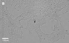 millicell-cell-lines-12022001-b Brightfield imaging of HEK 293T cells on Millicell<sup>®</sup> DCI Digital Cell Imager at 20X magnification