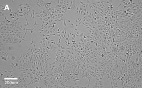 millicell-cell-lines-84100401-a Brightfield imaging of MRC-5 Sv2 cells on Millicell<sup>®</sup> DCI Digital Cell Imager at 10X magnification