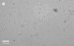 millicell-cell-lines-84100401-b Brightfield imaging of MRC-5 SV2 cells on Millicell<sup>®</sup> DCI Digital Cell Imager at 20X magnification