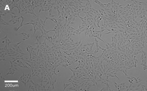 millicell-cell-lines-84113001-a Brightfield imaging of Vero cells on Millicell<sup>®</sup> DCI Digital Cell Imager at 10X magnification