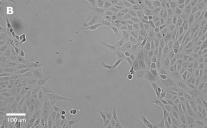 millicell-cell-lines-84113001-b Brightfield imaging of Vero cells on Millicell<sup>®</sup> DCI Digital Cell Imager at 20X magnification