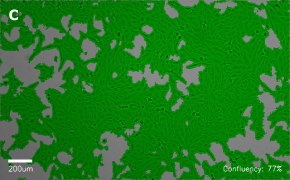 millicell-cell-lines-84113001-c Brightfield imaging of Vero cells on Millicell<sup>®</sup> DCI Digital Cell Imager at 10X magnification with mask