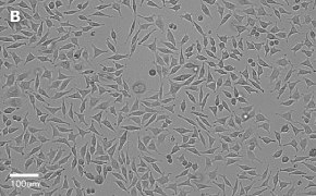 millicell-cell-lines-85011425-b Brightfield imaging of L929 cells on Millicell<sup>®</sup> DCI Digital Cell Imager at 20X magnification