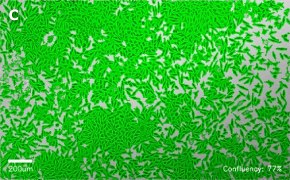 millicell-cell-lines-85011425-c Brightfield imaging of L929 cells on Millicell<sup>®</sup> DCI Digital Cell Imager at 10X magnification with mask