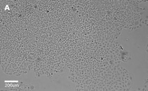 millicell-cell-lines-85020206-a Brightfield imaging of C1008 cells on Millicell<sup>®</sup> DCI Digital Cell Imager at 10X magnification