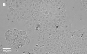 millicell-cell-lines-85020206-b Brightfield imaging of T24T cells on Millicell<sup>®</sup> DCI Digital Cell Imager at 20X magnification